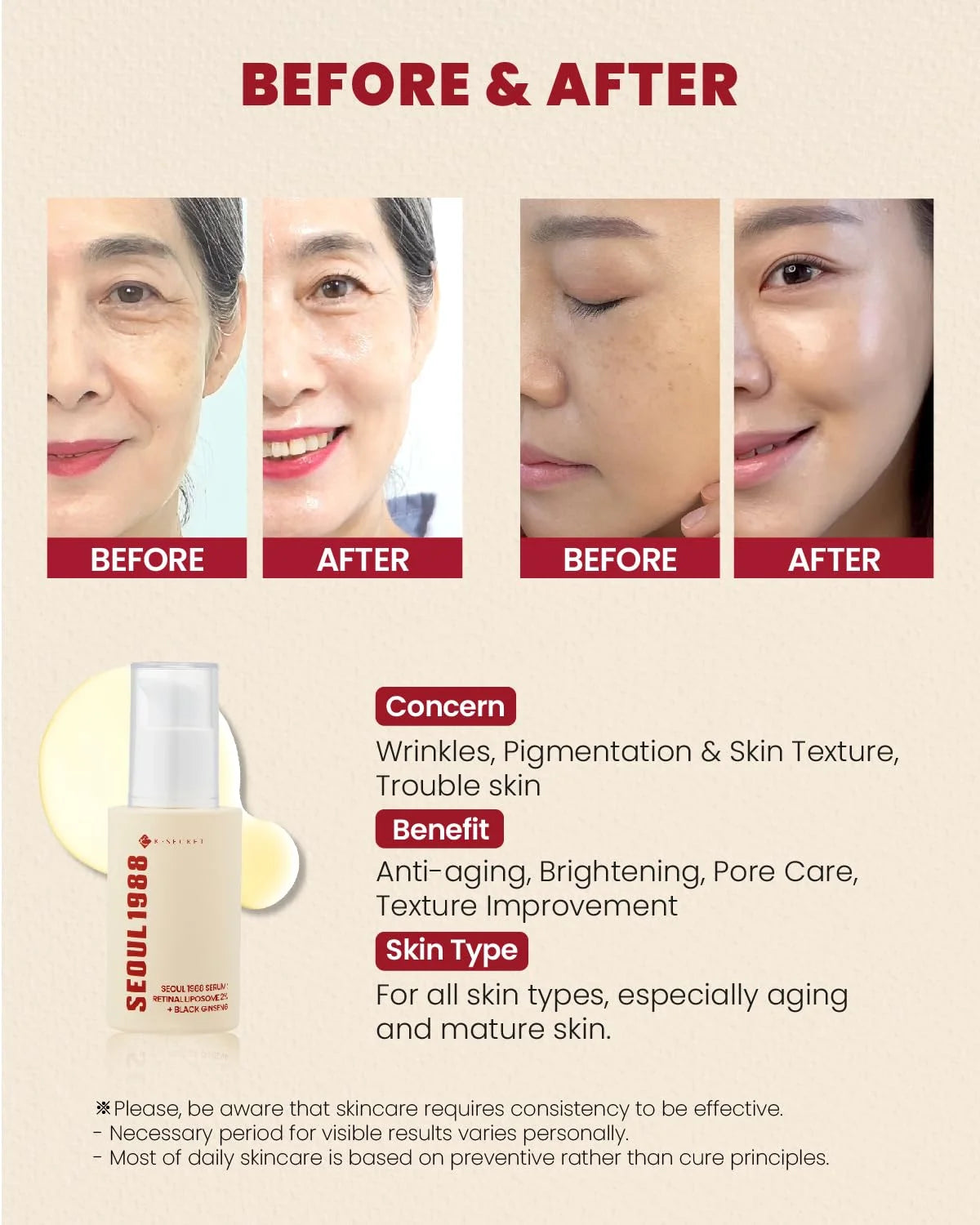 KSECRET - SEOUL 1988 Serum: Retinal Liposome 2% + Black Ginseng 30ml