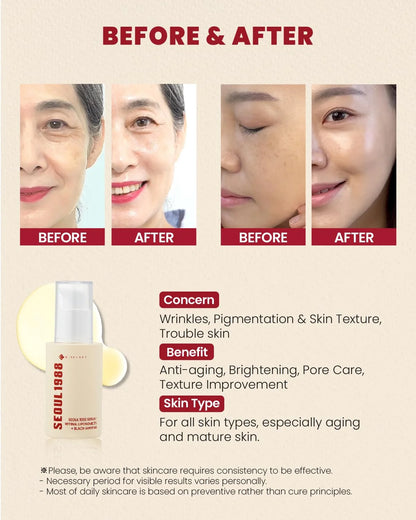 KSECRET - SEOUL 1988 Serum: Retinal Liposome 2% + Black Ginseng 30ml